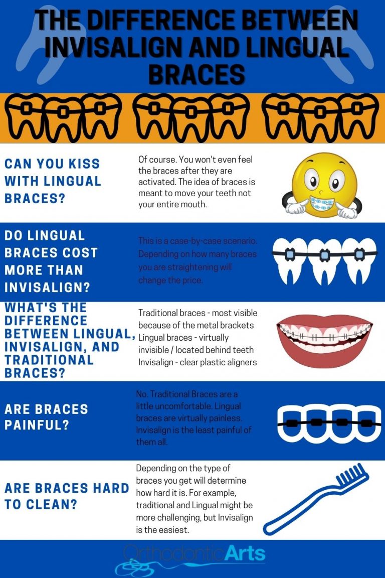 invisalign vs braces